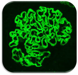 anti-GBM linear staining